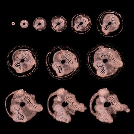 Embryogenesis #2