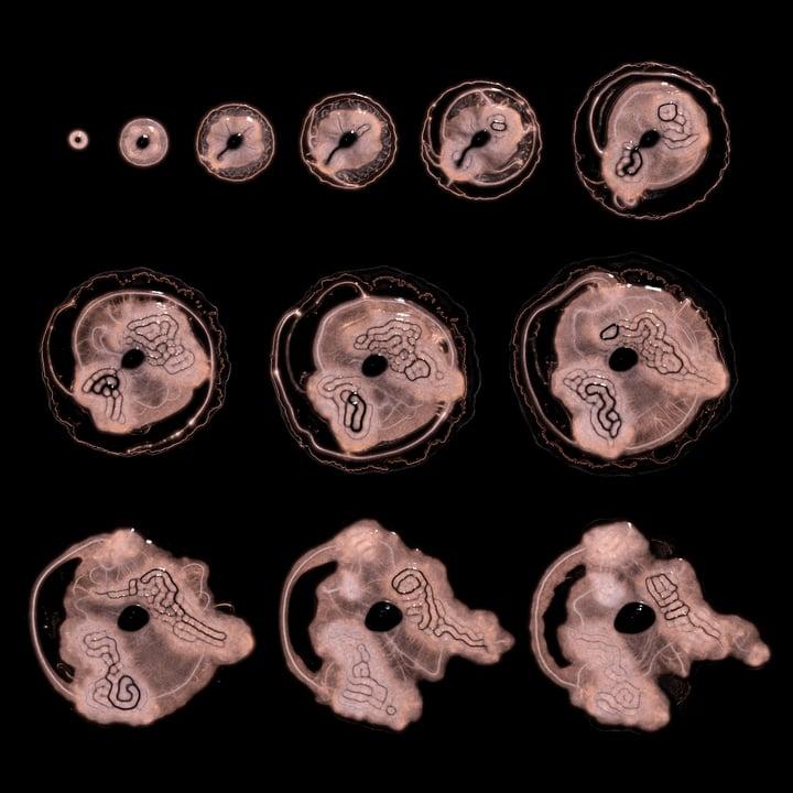 Embryogenesis #37