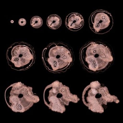 Embryogenesis #41