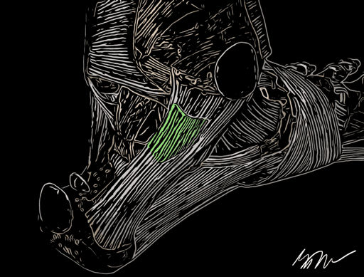 Posterior Tibiotaler LIgament