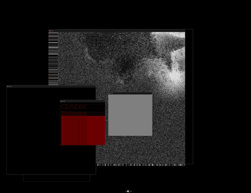 Cerebellum #202