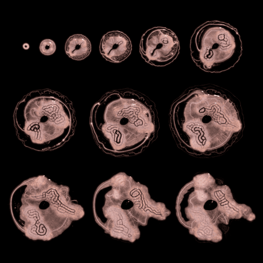 Embryogenesis #33